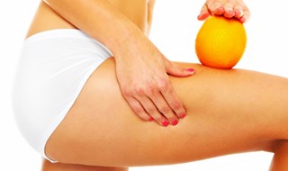 Cellulite: la nuova frontiera della Carbossiterapia